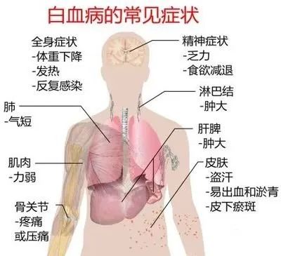 fd6e8608ecaa8acda32bd1c27c65c650.jpg
